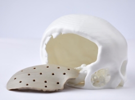 Kumovis: Solvay und Renolit investieren in 3D-Druck für Medizintechnik                                                          