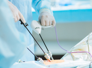 Neue glasfasergefüllte Polycarbonate für Anwendungen wie zum Beispiel laparoskopische chirurgische Instrumente (Foto: Covestro)