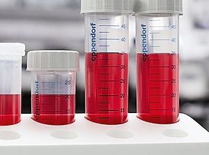 Laborbedarfsartikel aus Kunststoff: Reaktionsgefäße für die Bearbeitung von Proben (Foto: Eppendorf)